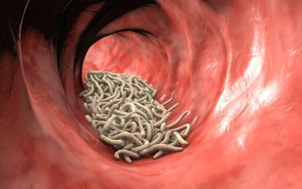 How To Know if You Have Intestinal Worms or Parasites: Signs and Symptoms